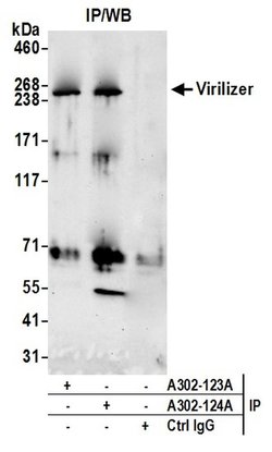 Virilizer Rabbit anti-Human, Polyclonal, Bethyl Laboratories 100 &mu;l;