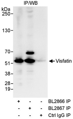 NAMPT/PBEF/Visfatin Rabbit anti-Human, Polyclonal, Bethyl Laboratories