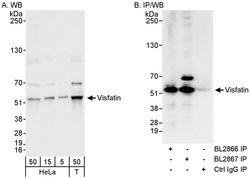 NAMPT/PBEF/Visfatin Rabbit anti-Human, Polyclonal, Bethyl Laboratories