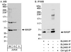 WASP Rabbit anti-Human, Polyclonal, Bethyl Laboratories 100 &mu;L; Unconjugated:Antibodies,