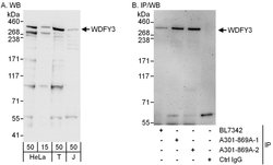WDFY3 Rabbit anti-Human, Polyclonal, Bethyl Laboratories 100 &mu;L; Unconjugated:Antibodies,