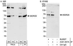 WDR20 Rabbit anti-Human, Mouse, Polyclonal, Bethyl Laboratories 100 &mu;l;