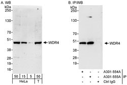 WDR4 Rabbit anti-Human, Polyclonal, Bethyl Laboratories 100 &mu;L; Unconjugated:Antibodies,