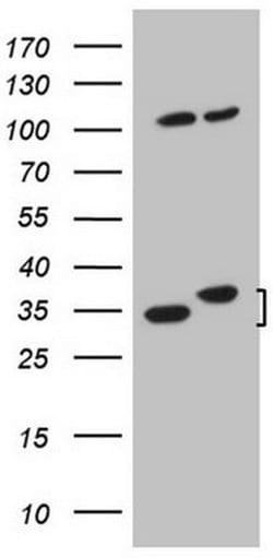 WDR61 Monoclonal Antibody (OTI4C4), TrueMAB , OriGene 100 &mu;L; Unconjugated:Antibodies,