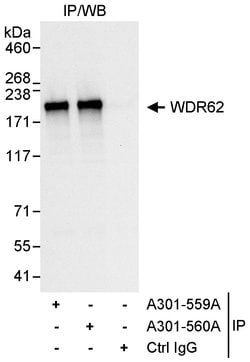 WDR62 Rabbit anti-Human, Polyclonal, Bethyl Laboratories 100 &mu;L; Unconjugated:Antibodies,