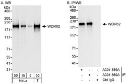 WDR62 Rabbit anti-Human, Polyclonal, Bethyl Laboratories 100 &mu;l; Unlabeled:Antibodies,