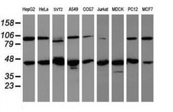 WDR74 Monoclonal Antibody (OTI4F2), TrueMAB , OriGene 100 &mu;L; Unconjugated:Antibodies,