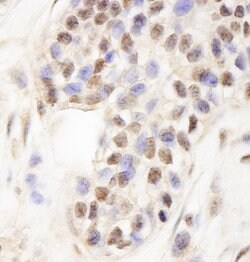 WDR79 Rabbit anti-Human, Polyclonal, Bethyl Laboratories 100 &mu;L; Unconjugated:Antibodies,