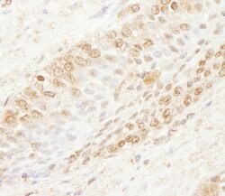 WDR91 Rabbit anti-Human, Polyclonal, Bethyl Laboratories 100 &mu;L; Unconjugated:Antibodies,