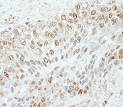 WDR91 Polyclonal Antibody, Bethyl Laboratories 100 &mu;L; Unconjugated:Antibodies,