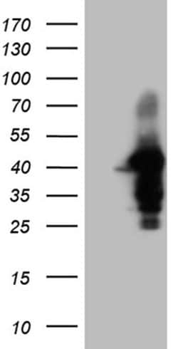WDR92 Monoclonal Antibody (OTI2F2), TrueMAB , OriGene 100 &mu;L; Unconjugated:Antibodies,