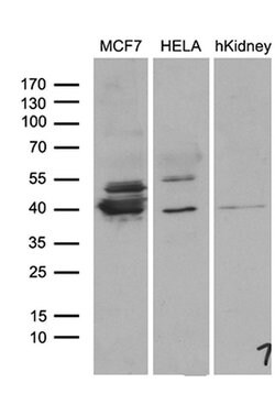 WDR92 Monoclonal Antibody (OTI4B9), TrueMAB , OriGene:Antibodies:Primary