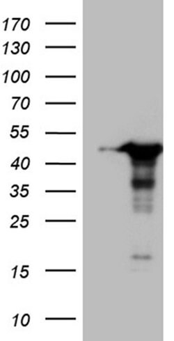 WDR92 Monoclonal Antibody (OTI5H5), TrueMAB , OriGene:Antibodies:Primary