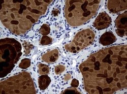 WFDC2 Monoclonal Antibody (OTI2A7), TrueMAB , OriGene 100 &mu;L; Unconjugated:Antibodies,
