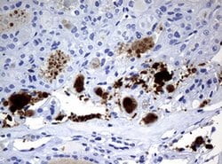 WFDC2 Monoclonal Antibody (OTI2A7), TrueMAB , OriGene:Antibodies:Primary