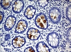 WFDC2 Monoclonal Antibody (OTI2A7), TrueMAB , OriGene 100 &mu;L; Unconjugated:Antibodies,