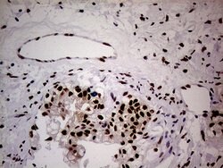 WHSC1L1 Monoclonal Antibody (OTI3B3), TrueMAB , OriGene 100 &mu;L; Unconjugated:Antibodies,