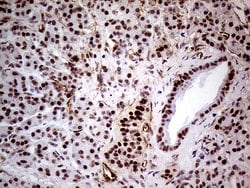 WHSC1L1 Monoclonal Antibody (OTI3B3), TrueMAB , OriGene 100 &mu;L; Unconjugated:Antibodies,