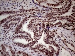 WHSC1L1 Monoclonal Antibody (OTI3B3), TrueMAB , OriGene 100 &mu;L; Unconjugated:Antibodies,