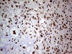 WHSC1L1 Monoclonal Antibody (OTI3B3), TrueMAB , OriGene 100 &mu;L; Unconjugated:Antibodies,