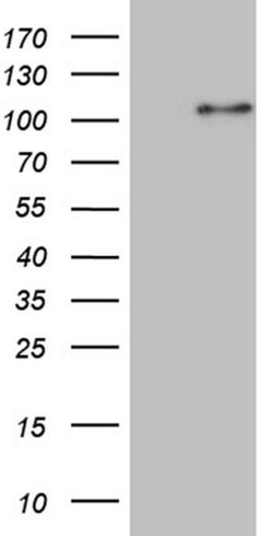 WHSC1L1 Monoclonal Antibody (OTI1F11), TrueMAB , OriGene 100 &mu;L; Unconjugated:Antibodies,