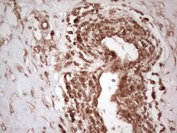 WIBG Monoclonal Antibody (OTI5E2), TrueMAB , OriGene 100 &mu;L; Unconjugated:Antibodies,