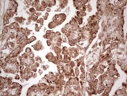 WIBG Monoclonal Antibody (OTI5E2), TrueMAB , OriGene 100 &mu;L; Unconjugated:Antibodies,