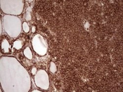 WIBG Monoclonal Antibody (OTI5E2), TrueMAB , OriGene 100 &mu;L; Unconjugated:Antibodies,