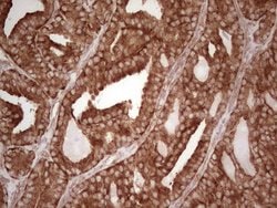 WIBG Monoclonal Antibody (OTI5E2), TrueMAB , OriGene 100 &mu;L; Unconjugated:Antibodies,