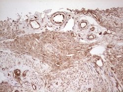 WIBG Monoclonal Antibody (OTI5E2), TrueMAB , OriGene 100 &mu;L; Unconjugated:Antibodies,