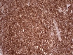WIBG Monoclonal Antibody (OTI5E2), TrueMAB , OriGene 100 &mu;L; Unconjugated:Antibodies,