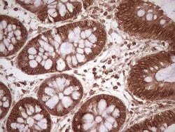 WIBG Monoclonal Antibody (OTI5E2), TrueMAB , OriGene 100 &mu;L; Unconjugated:Antibodies,