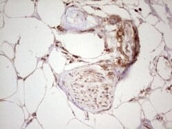 WIBG Monoclonal Antibody (OTI5E2), TrueMAB , OriGene 100 &mu;L; Unconjugated:Antibodies,