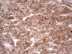 WIBG Monoclonal Antibody (OTI5E2), TrueMAB , OriGene 100 &mu;L; Unconjugated:Antibodies,