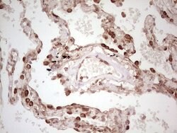 WIBG Monoclonal Antibody (OTI5E2), TrueMAB , OriGene 100 &mu;L; Unconjugated:Antibodies,