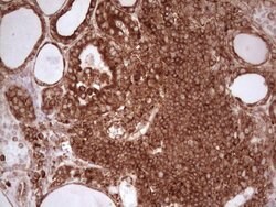 WIBG Monoclonal Antibody (OTI9C7), TrueMAB , OriGene 100 &mu;L; Unconjugated:Antibodies,