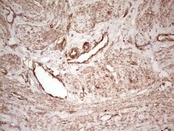 WIBG Monoclonal Antibody (OTI9C7), TrueMAB , OriGene 100 &mu;L; Unconjugated:Antibodies,