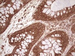 WIBG Monoclonal Antibody (OTI2C1), TrueMAB , OriGene 100 &mu;L; Unconjugated:Antibodies,