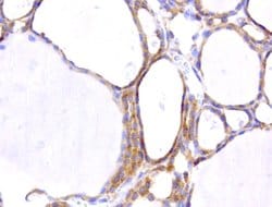 WIBG Mouse anti-Human, Clone: UMAB209, liquid, UltraMAB 100 &mu;L; Unconjugated:Antibodies,