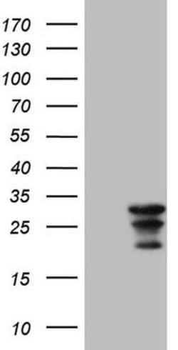 WIBG Monoclonal Antibody (OTI11C5), TrueMAB , OriGene:Antibodies:Primary
