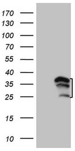 WIBG Mouse anti-Human, Clone: OTI8D7, lyophilized, TrueMAB 100 &mu;g; Unconjugated:Antibodies,