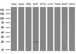 WIBG Mouse anti-Human, Clone: OTI8D7, lyophilized, TrueMAB 100 &mu;g; Unconjugated:Antibodies,