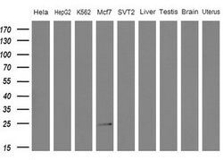 WIBG Monoclonal Antibody (OTI8D7), TrueMAB , OriGene:Antibodies:Primary