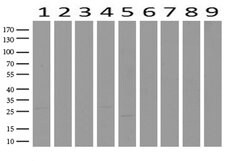 WIBG Mouse anti-Human, Clone: UMAB209, liquid, UltraMAB 100 &mu;L; Unconjugated:Antibodies,