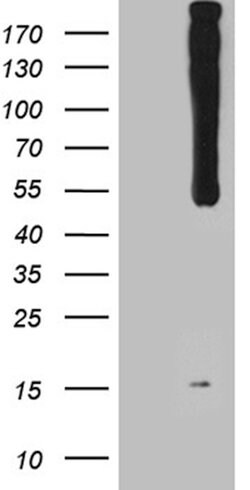 WIPI1 Mouse anti-Human, Clone: OTI11B11, lyophilized, TrueMAB 100 &mu;g;