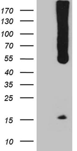 WIPI1 Monoclonal Antibody (OTI8F9), TrueMAB , OriGene:Antibodies:Primary