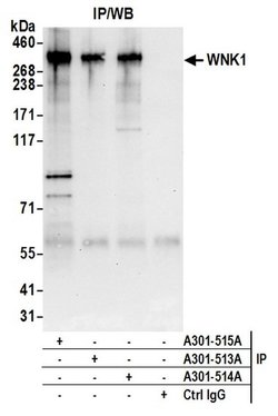 WNK1 Rabbit anti-Human, Polyclonal, Bethyl Laboratories 100 &mu;L; Unconjugated:Antibodies,