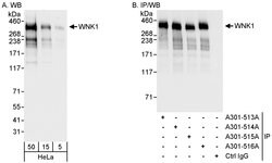 WNK1 Rabbit anti-Human, Polyclonal, Bethyl Laboratories 100 &mu;L; Unconjugated:Antibodies,