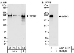 WNK3 Rabbit anti-Human, Polyclonal, Bethyl Laboratories 100 &mu;L; Unconjugated:Antibodies,