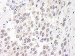 WRN Polyclonal Antibody, Bethyl Laboratories:Antibodies:Primary Antibodies